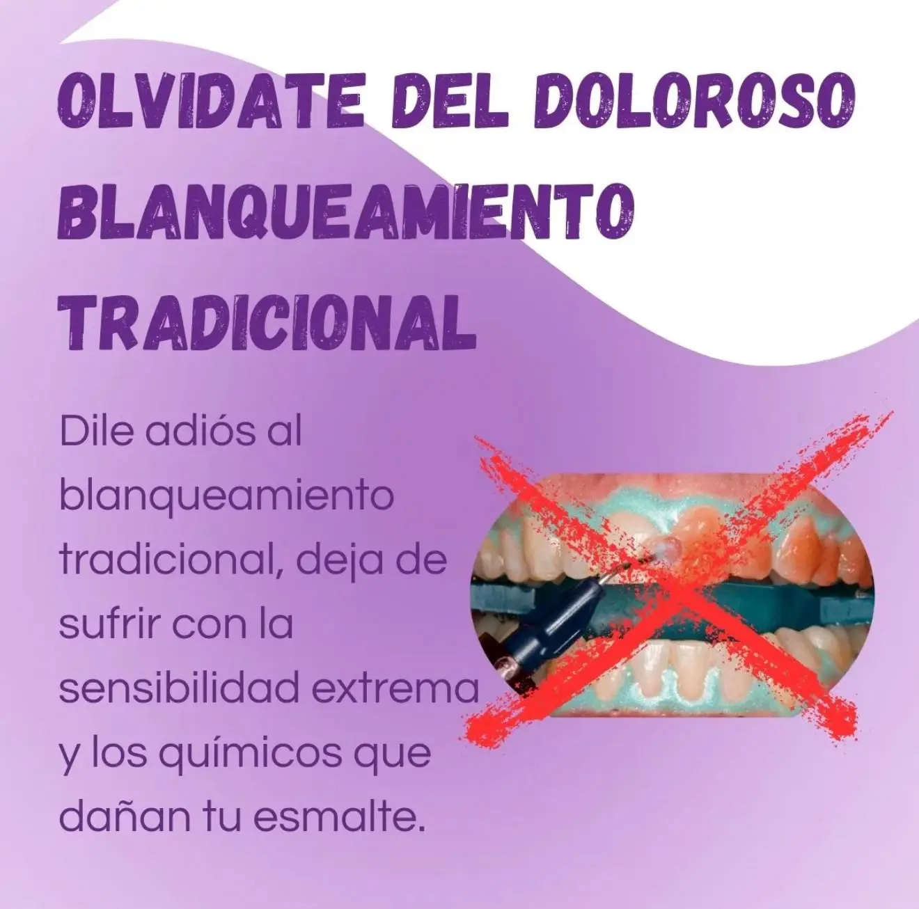 Set x2 Parche blanqueador de dientes 7 sobres de estética dental - Elimina las manchas superficiales para lograr una sonrisa brillante