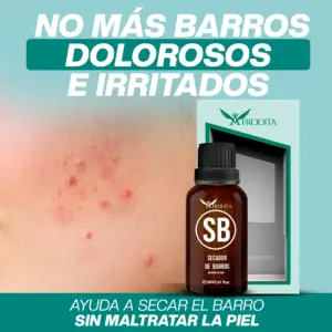 Serum facial secador de barros y espinillas con protección UV - Elimina los brotes rápidamente mientras cuida tu piel